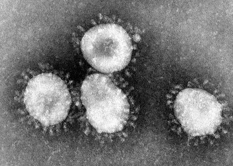 Virióny koronavírusu v elektrónovom mikroskope (poznámka: nie je to SARS-CoV-2)