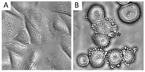 Bunky podliehajúce apoptóze (B) a kontrolná vzorka (A)