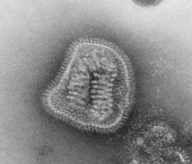 Vírus chrípky v elektrónovom mikroskope