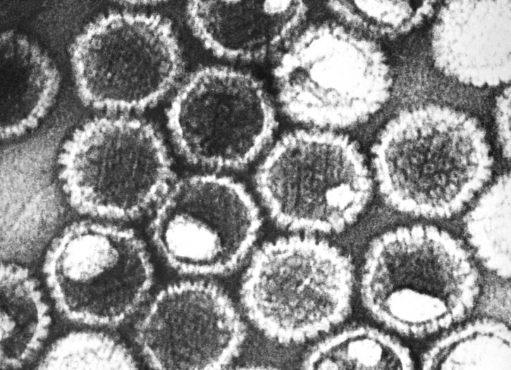 Virióny HSV v elektrónovom mikroskope