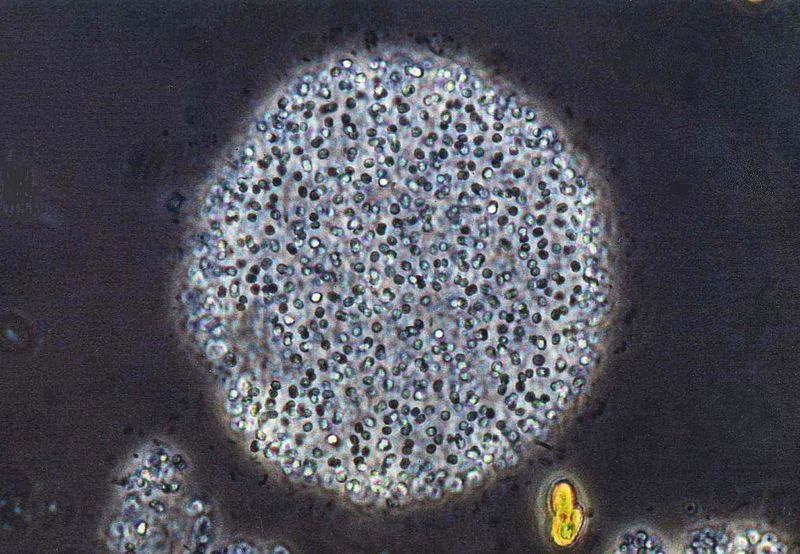 Microcystis stagnalis