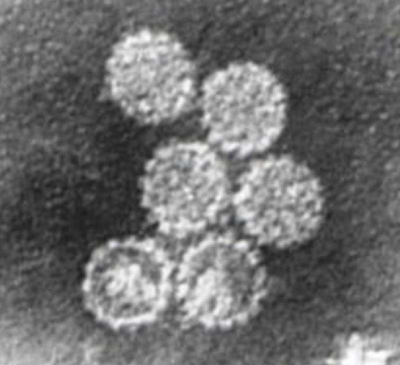 Virióny HPV v elektrónovom mikroskope