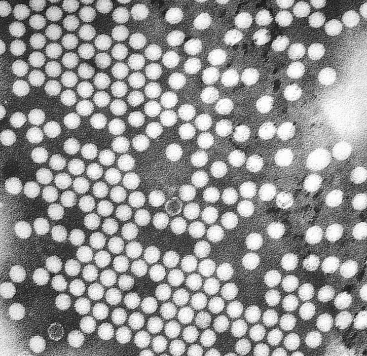 Virióny poliovírusu v elektrónovom mikroskope