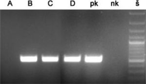 Príklad elektroforetogramu s pozitívnou a negatívnou kontrolou PCR