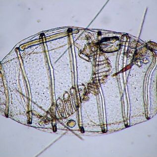 Zástupca rodu Doliolum