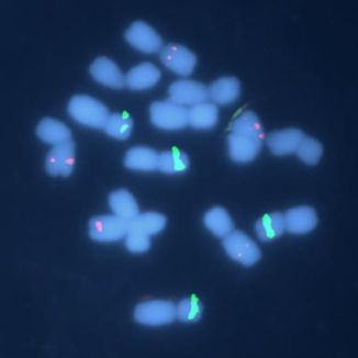 Fluorescenčná in-situ hybridizácia (FISH)