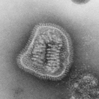 Vírus chrípky v elektrónovom mikroskope