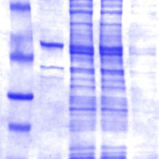 Polyakrylamidový gél farbený Coomassie Brilliant Blue R-250