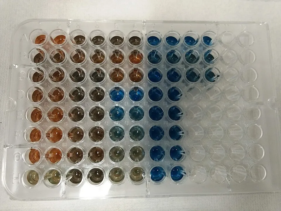 Modré zafarbenie pri Bradfordovej metóde stanovenia proteínov